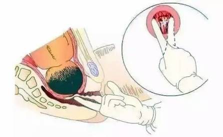 C:\Users\Lenovo\AppData\Local\Temp\WeChat Files\139138198990620940.jpg