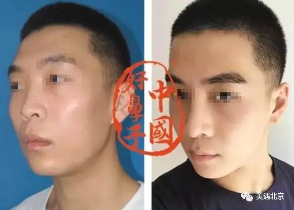 1496974991445107.jpg 1496974991445107.jpg