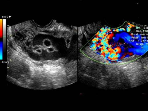 何主任对孕妇的建议