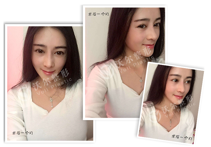 1486460014317009820.png 图片4.png