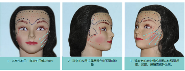 可调式微升美来了,全面部抗衰提升你的颜值!